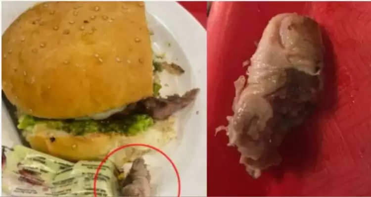 रेस्टोरेंट में चिकन बर्गर खाने पहुंची महिला के पहले निवाले में ही निकली इंसान की उंगली