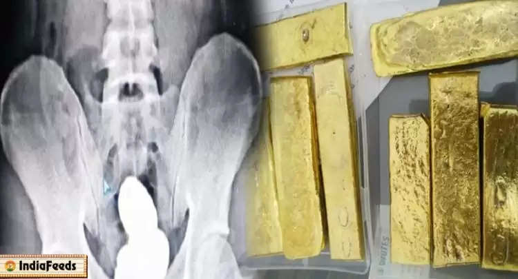 एक्स-रे मशीन में पकड़ा गया 10 लाख का सोना