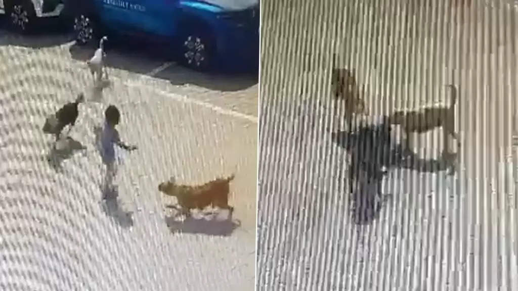 dog bites a child